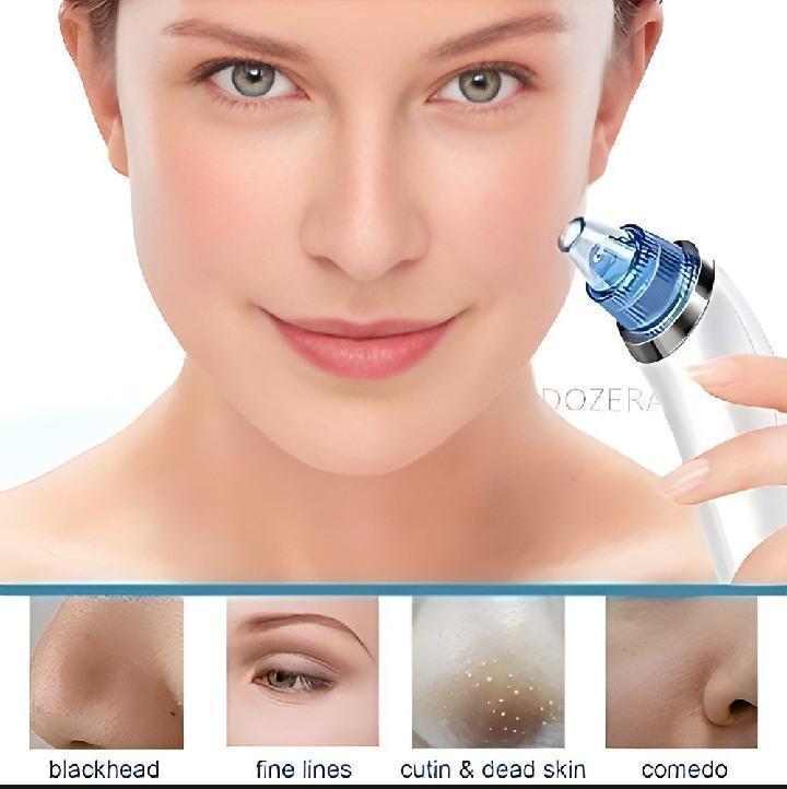 Dead Skin Removal Derma Suction Facial Cleanser - 1 Pack