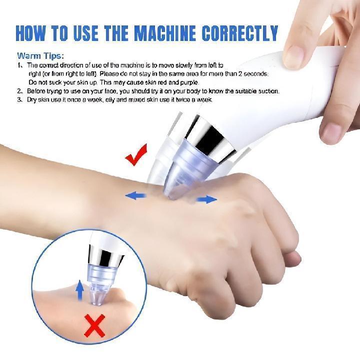 Dead Skin Removal Derma Suction Facial Cleanser - 1 Pack